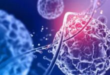 Photo of कैंसर के शुरुआत में नजर आते हैं ये 5 लक्षण