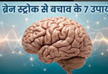 Photo of ब्रेन स्ट्रोक का खतरा टाल सकती हैं आपकी ये 7 आदतें