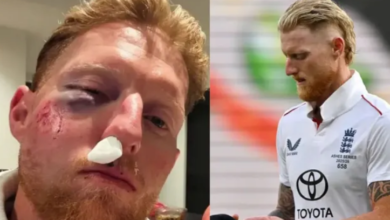 Photo of इंग्लैंड के कप्तान बेन स्टोक्स के चेहरे पर लगी भयानक चोट