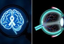 Photo of क्या आंखों की जांच से सालों पहले लग सकेगा अल्जाइमर का पता?