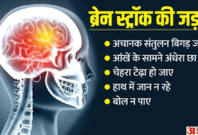 Photo of क्या ज्यादा स्ट्रेस लेने से आ सकता है ब्रेन स्ट्रोक? AIIMS ट्रेंड न्यूरोसर्जन ने दिया जवाब