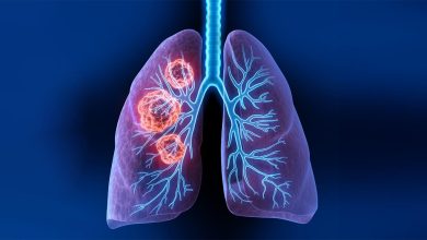 Photo of क्या सांस फूलना फेफड़ों के कैंसर का लक्षण है? WHO के अनुसार Lung Cancer के 7 संकेत कौन से हैं, जानिए यहां ????