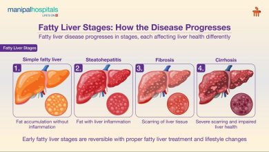 Photo of NAFLD Symptoms: फैटी लिवर की समस्या आजकल काफी आम हो रही है। खास बात यह है कि शुरुआती दौर में ज्यादातर लोगों को इसके कोई स्पष्ट लक्षण महसूस नहीं होते???